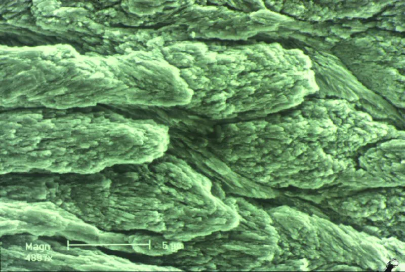 Image described by caption.