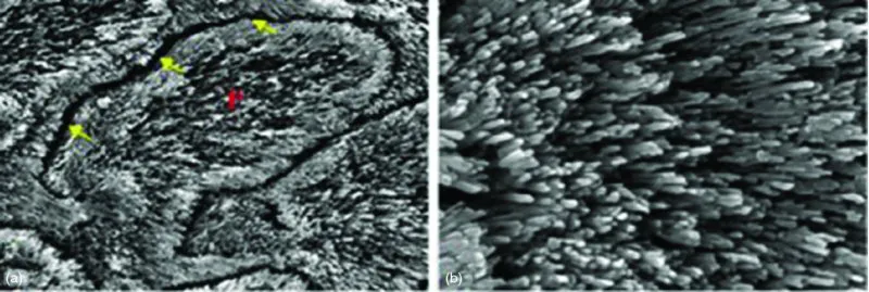 Image described by caption.