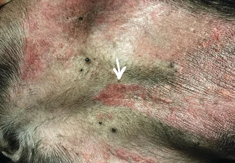 Image described by caption.