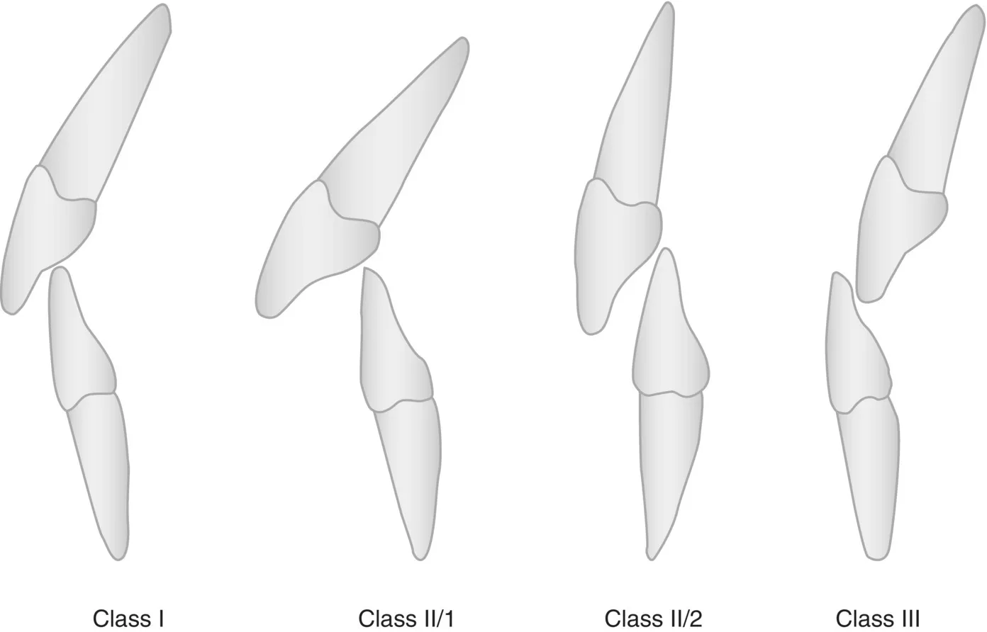 Image described by caption and surrounding text.