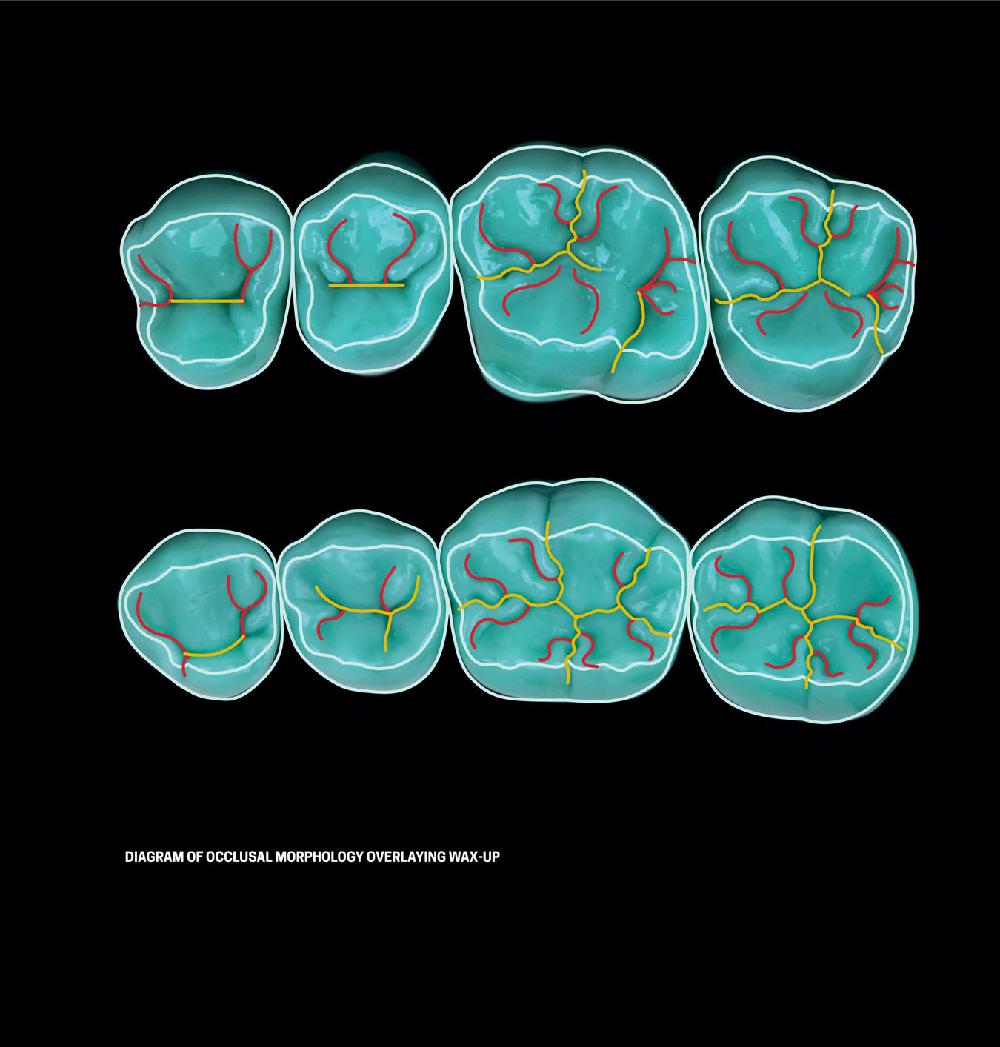 [PDF] Dental Anatomy and Morphology by Hilton Riquieri eBook Perlego