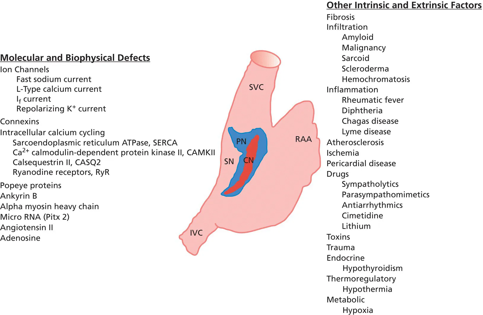 Diagram of the right atrium of the heart displaying the central node, sinus node, etc. The molecular and biophysical defects are listed at the left, while the other intrinsic and extrinsic factors are listed at the right.
