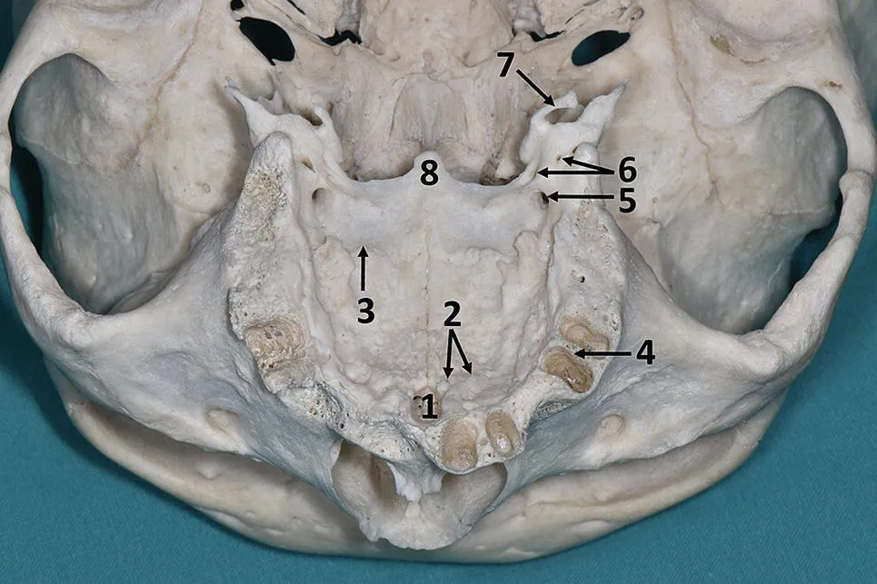 Photo depicts the inferior view hard palate in which the incisive foramen, incisive suture, transverse palatine suture, interalveolar septum, greater palatine foramen, lesser palatine foramina, hamulus pterygoidei, posterior nasal spine are marked with numbers.