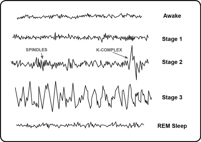 Figure 1. Electrical waveforms of the three states of consciousness.