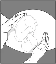 Figure 2 Lateral palpation