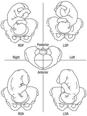 Figure 9 Fetal position