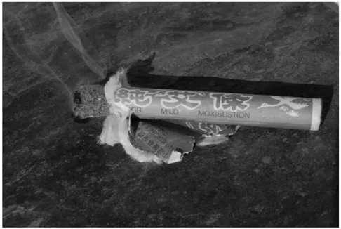 PHOTO 1.4. A moxa stick as used for moxibustion within traditional Chinese medicine.
