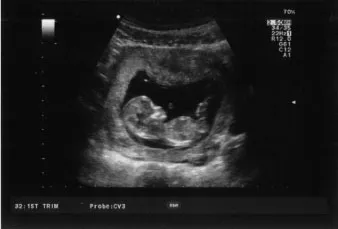 Figure 1.2 Scan of my unborn grandson, downloaded from Facebook.