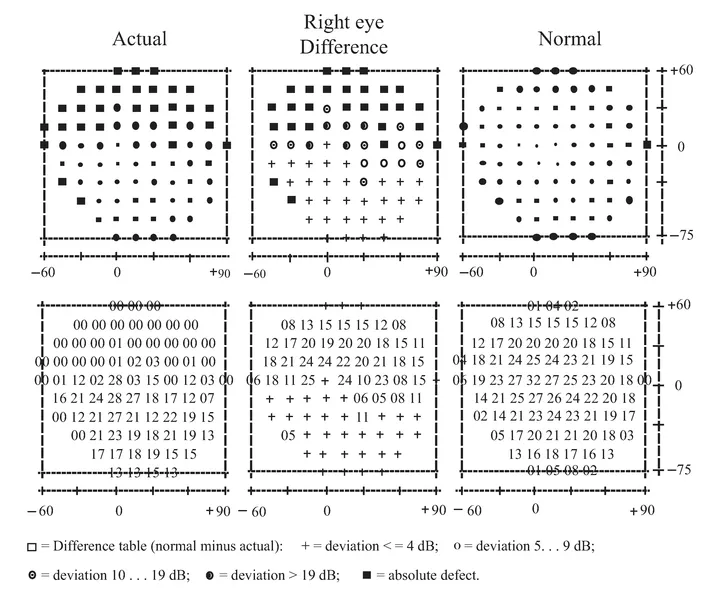 FIGURE 1.3 Results of Octopus perimetric recordings of H.J.A.’s visual fields.