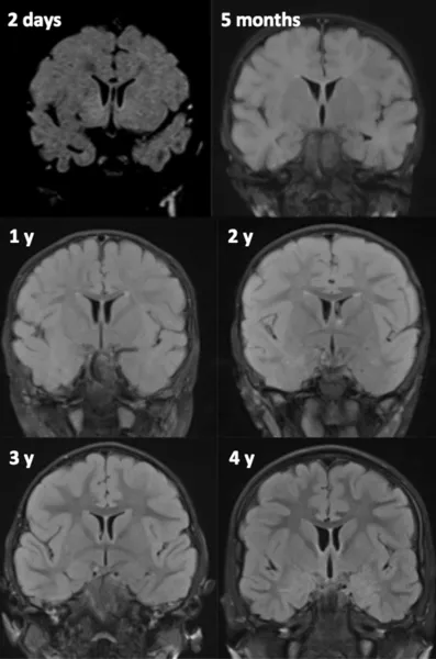 f57-01-9780444534866