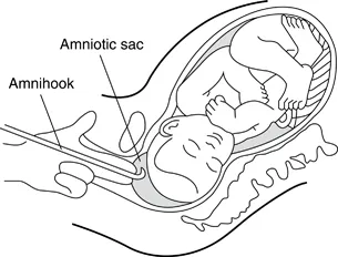 Figure 20