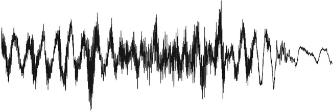 Figure 1.1 Creaky voice: waveform showing aperiodicity in a speech signal realized after neck cancer. With thanks to Dr. Lisette van der Molen, Netherlands Cancer Institute, Amsterdam, the Netherlands.