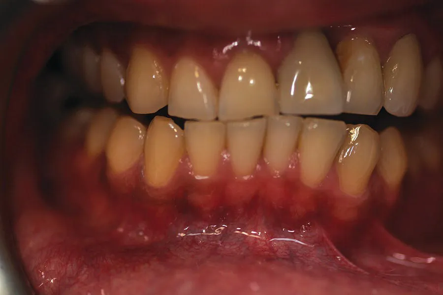 Photo depicts a healthy mouth of an Asian person.