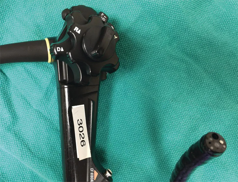 Photo depicts endoscope with control handle and tip. The tip contains a light source, imaging window, and accessory channel through which various tissue acquisition devices can be passed.