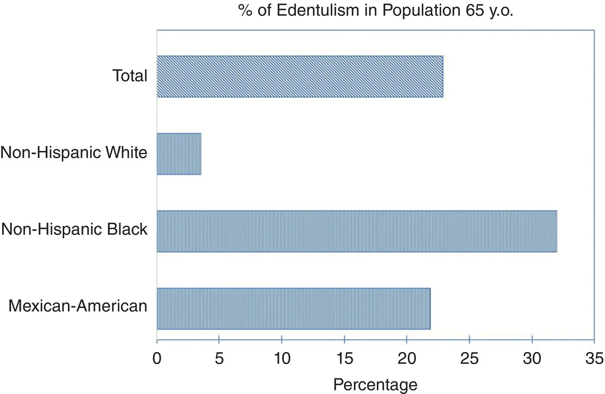 Bar chart depicts prevalence of edentulism by race and ethnicity in adults lesser than equal to 65 years [9].