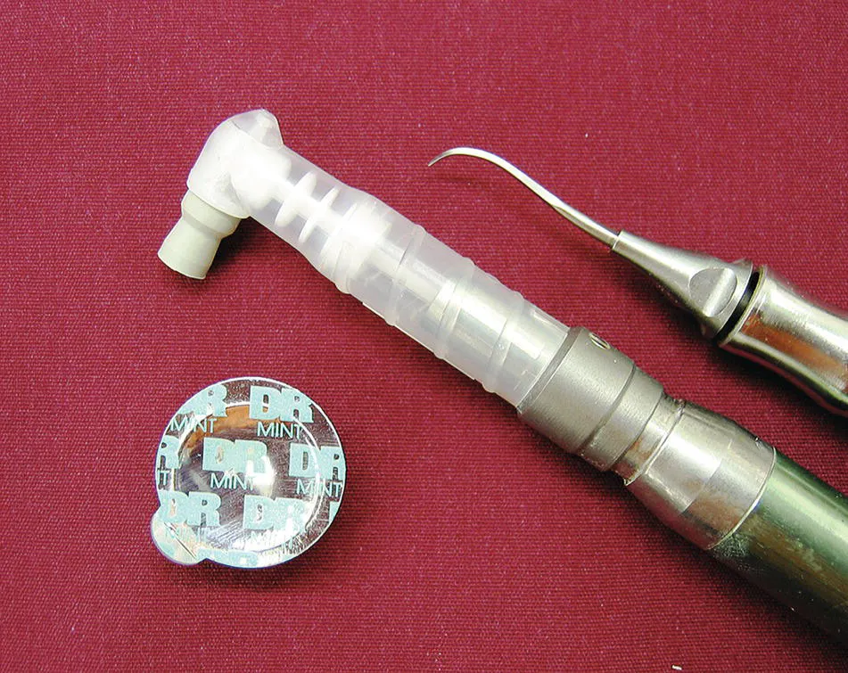 Photo depicts prophy paste, prophy angle, and ultrasonic scaling tip.