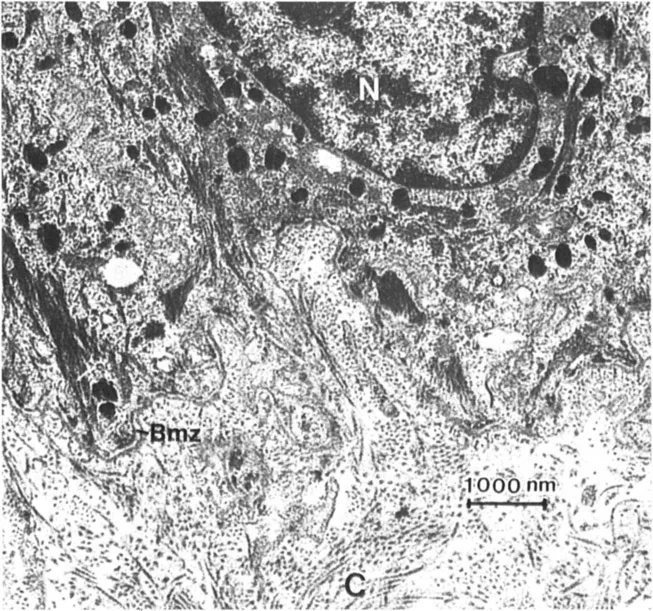 Figure 1 Transmission electron micrographs of the dermal-epidermal junction at two magnifications. A variety of fibrous structure are identified: collagen fibers (C); the basement membrane zone (Bmz), which includes the lamina lucida (LI) and the lamina densa (Ld); anchoring fibrils (AF); anchoring filaments (af); and the reticular network (Rn). The nucleus (N) and hemidesmosomes (H) are also identified.
