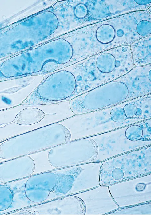 Onion Cells