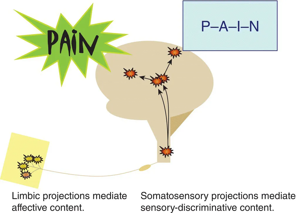 Schematic illustration of sensory-discriminative and emotional-motivational components.