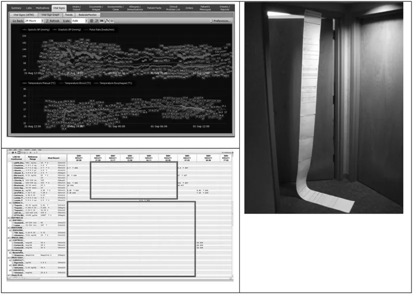 Figure 1.1 Visualization of physiological parameters within EMR (information overload), (Bottom Left) visualization of laboratory parameters in spreadsheet-like EMR (lack of information), and (Right) printed-on-paper pre-anesthesia evaluation electronic form (EMR data entry).