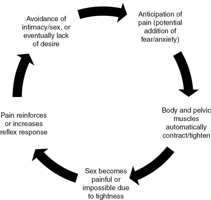 Diagram depicting how the vaginismus pain cycle develops.