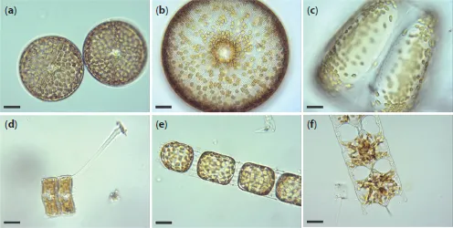 Photos depict living diatoms as observed under LM, brightfield.