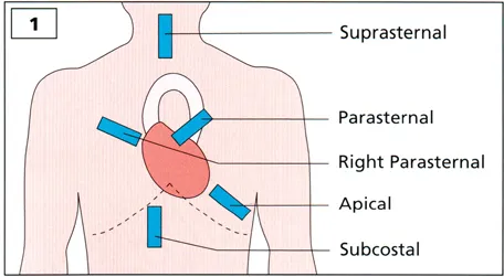 1. Transducer positions to obtain parasternal, apical, subcostal, and suprasternal echo images.