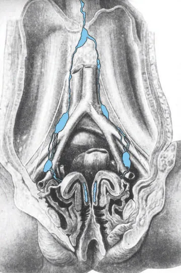 FIGURE 1.4 Leveuf and Godard’s2 description (1923) of lymphatic drainage of the cervix. (Courtesy of Dr. Daniel Dargent.)