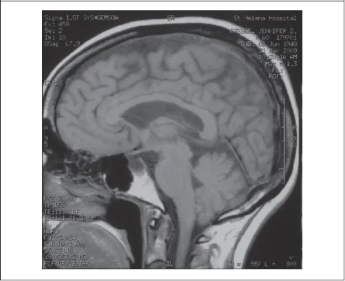 Figure 1.3. MRI Scan