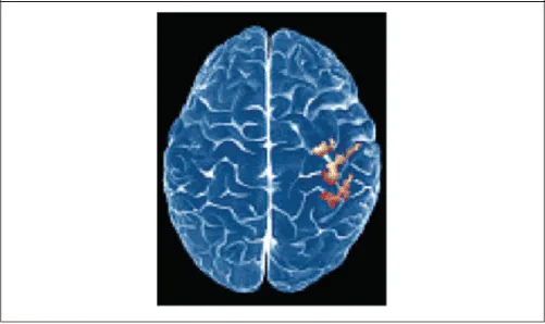 Figure 1.5. fMRI Scan