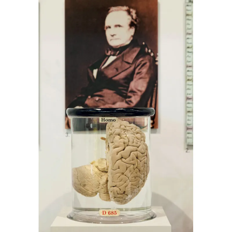Il cervello di Babbage, conservato in una teca del Museo di Scienze Naturali a Londra (ma sarà proprio il suo?). © RGB Ventures LLC dba SuperStock / Alamy