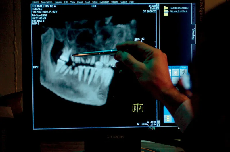 La radiografia della dentatura che ha permesso di scoprire i resti della potente Hatshepsut, che regnò come faraone per quasi vent’anni.