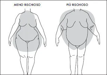Rapporto vita/fianchi e tipologia di obesità.