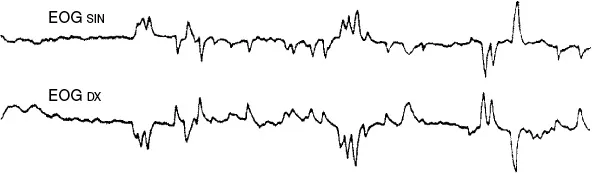 Fig. 1.2. Attività oculare nel corso del sonno REM. E0G: elettrooculogramma (modificata da Mancia, 1996).