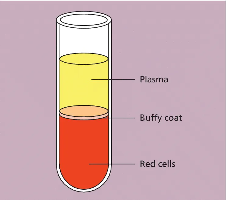 Diagram of a tube of anticoagulated blood illustrating the separation of blood with lines depicting the plasma (top layer), buffy coat (middle layer), and red cells (bottom layer).
