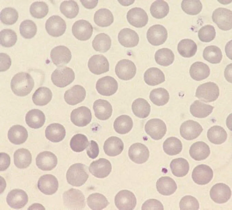 Micrograph displaying normal red cells with little variation in size and shape. Small structures of platelets between the red cells.