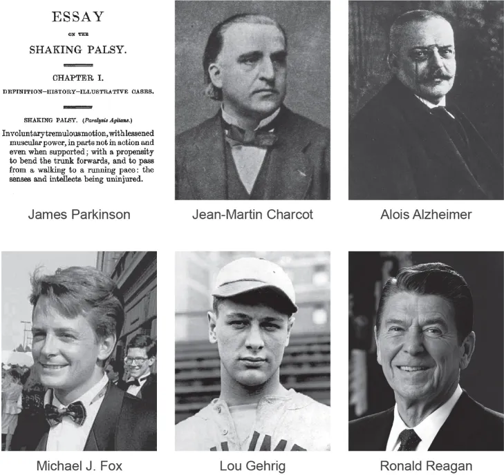 Photos showing James Parkinson “Essay on the Shaking Palsy” note, Jean-Martin Charcot, Alois Alzheimer, Michael J. Fox, Lou Gehrig, and Ronald Reagan.