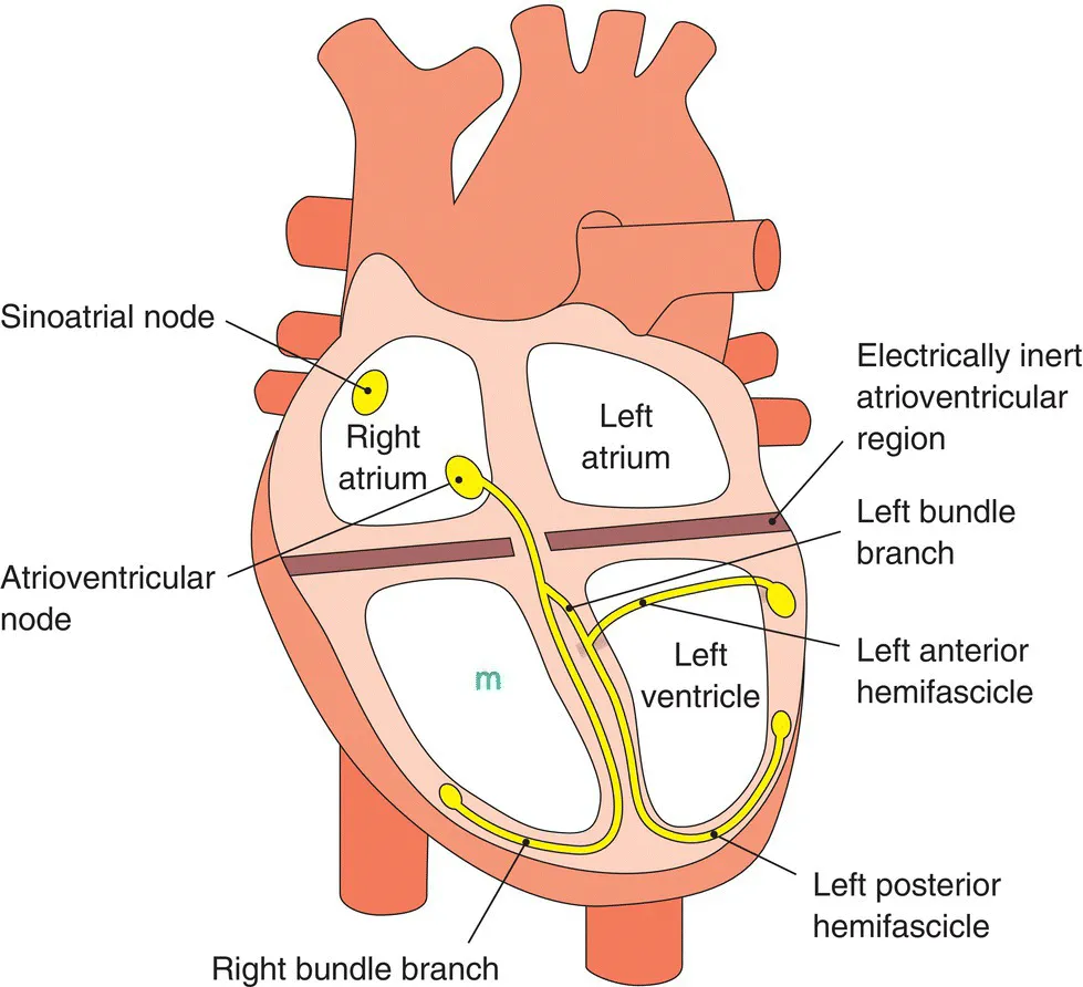 Diagram of the conduction system of the heart with lines indicating electrically inert atrioventricular region, left bundle branch, left anterior hemifascicle, left posterior hemifascicle, right bundle branch, etc.
