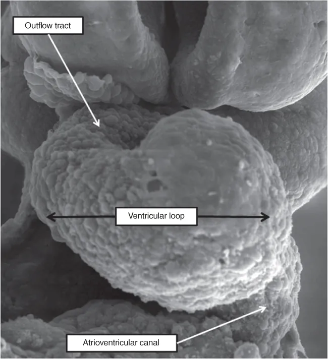 SEM image of developing heart of the mouse at E9.5.