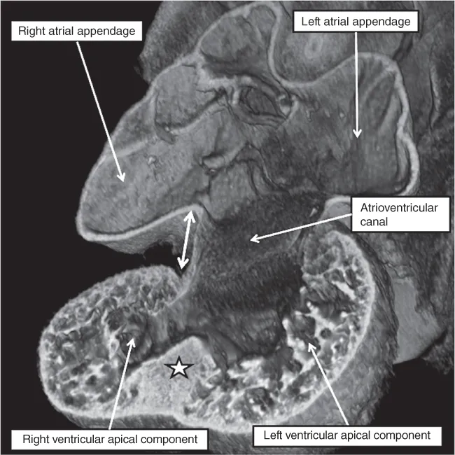 SEM image of developing mouse embryo early on embryonic day 11.5.