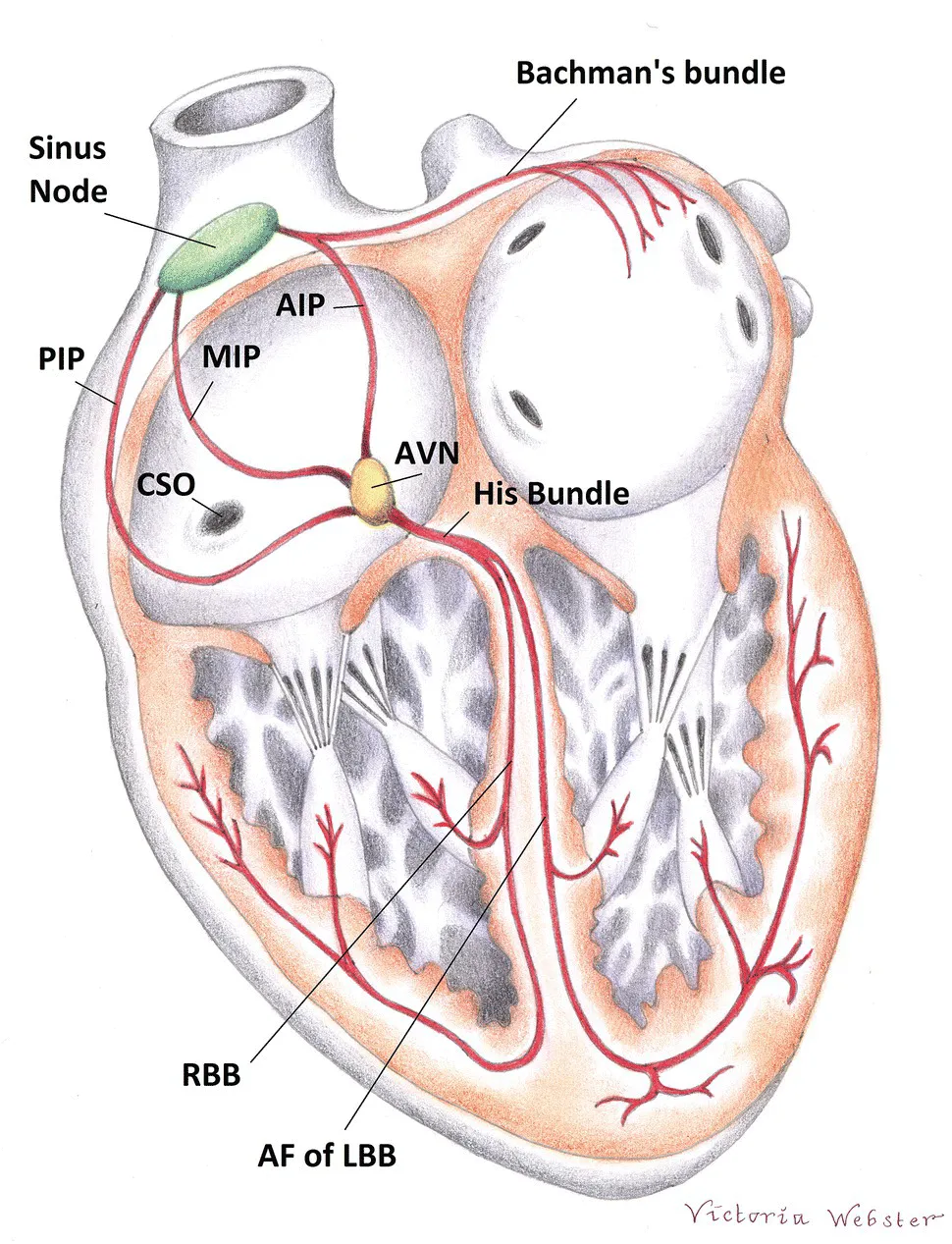 Cross section of the heart with lines pointing at the sinus node, Bachman's bundle, His bundle, AVN, RBB, AF of LBB, CSO, MIP, AIP, and PIP.