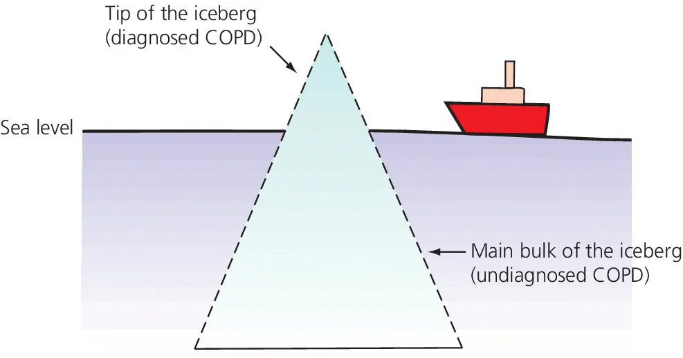 Schematic displaying a dashed triangle representing the tip of the iceberg (diagnosed COPD) and main bulk of the iceberg (undiagnosed COPD)designated by arrow, with an illustration of a ship at the upper right.