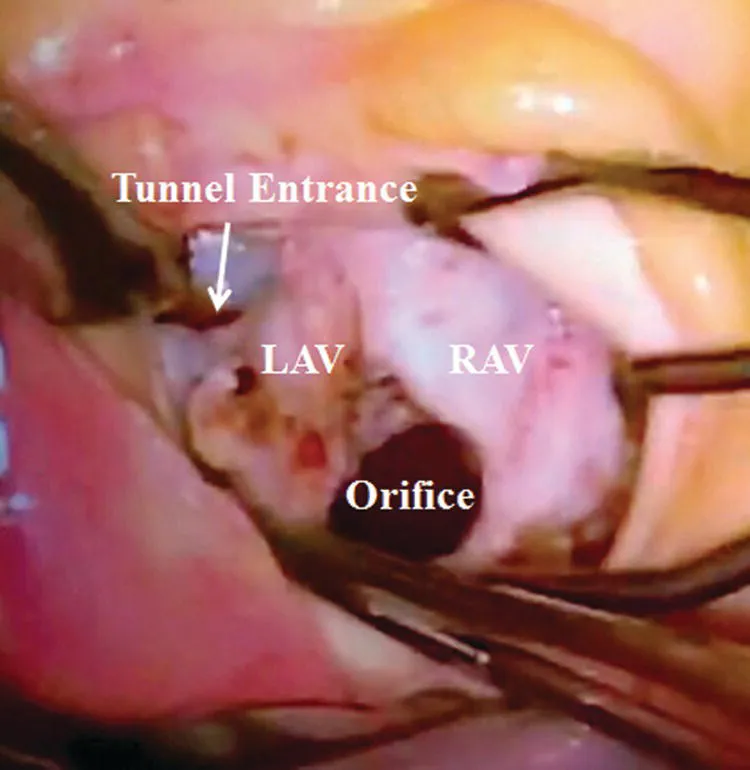 Image described by caption.