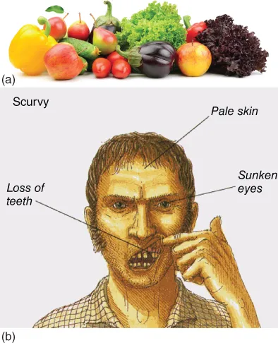“Digital capture of fruits containing itamin C marked (a). Schematic diagram of a person's face with signs of scurvy: pale skin, sunken eyes, and loss of teeth. The diagram is marked (b).”