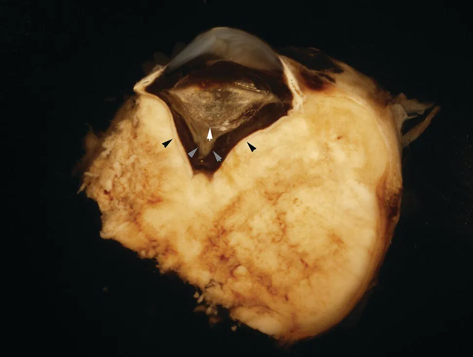 Image described by caption.