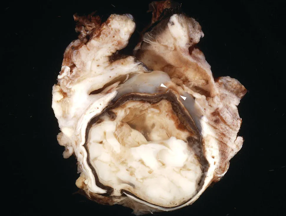 Image described by caption.