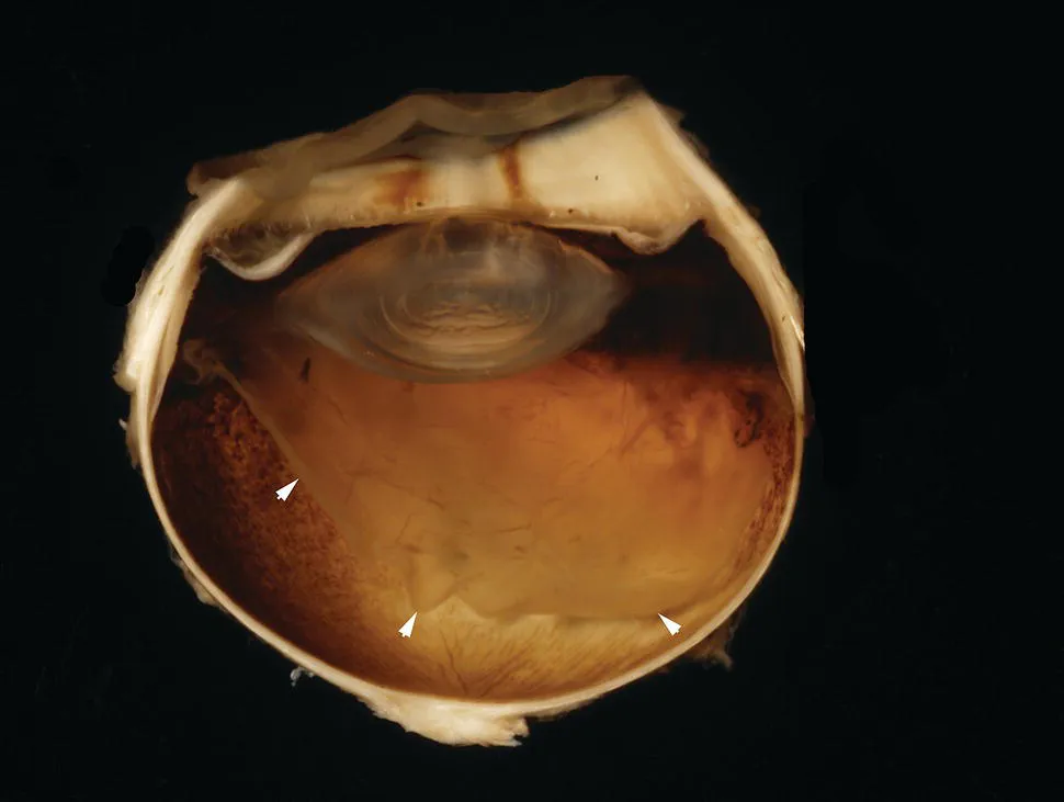 Image described by caption.