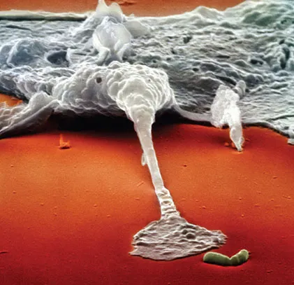 Figure shows the electron micrograph picture of microphage about to devour bacterium by reaching out a foot to grab invading bacterium.
