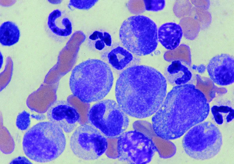 100 times magnification of canine bone marrow smear showing granulocytic precursors. The majority of the intact cells present are granulocytic precursors with oval to indented nuclei and blue cytoplasm. The larger immature forms have small, pink cytoplasmic granules. The cytoplasm becomes less blue as the cells mature.