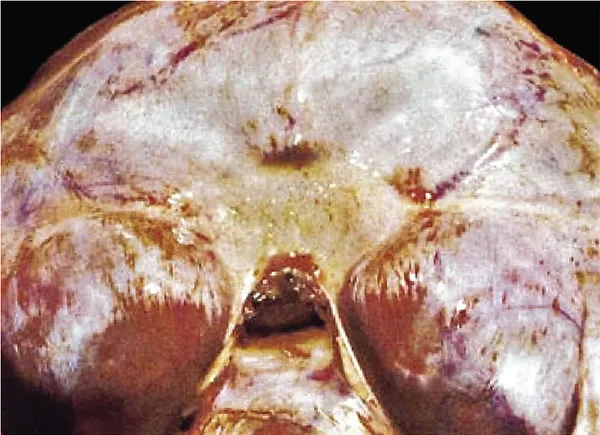 image described by caption.